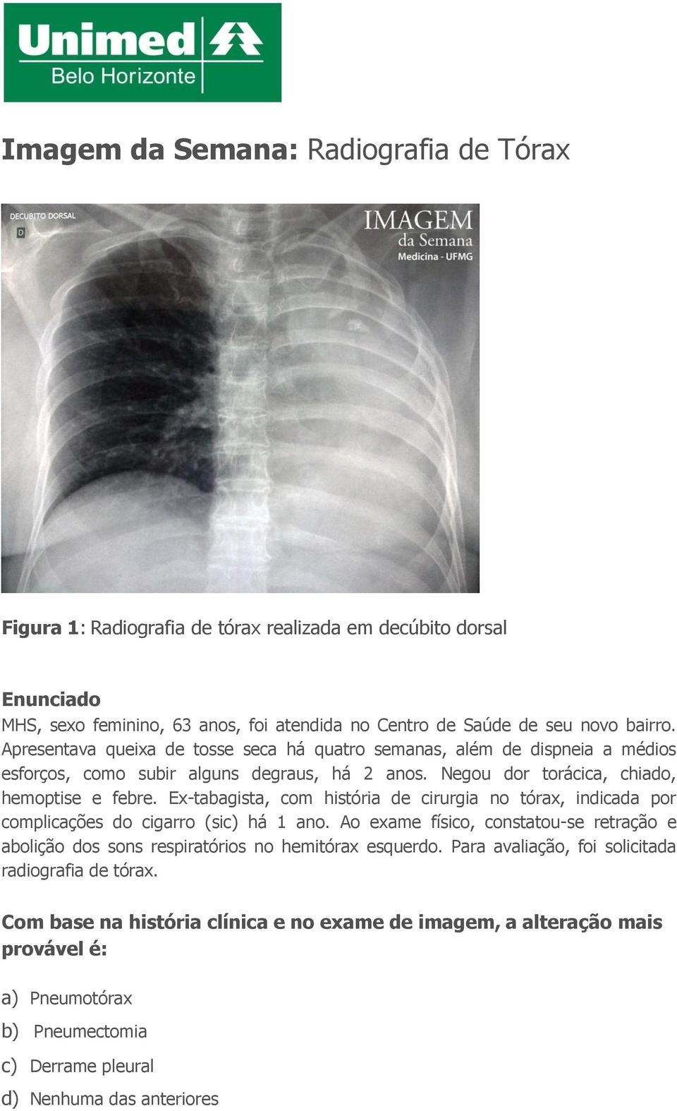 Ex-tabagista, com história de cirurgia no tórax, indicada por complicações do cigarro (sic) há 1 ano.