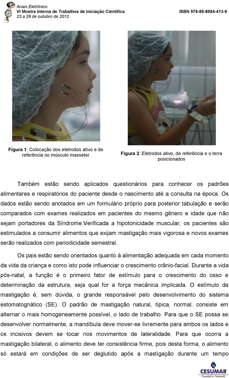 Os dados estão sendo anotados em um formulário próprio para posterior tabulação e serão comparados com exames realizados em pacientes do mesmo gênero e idade que não sejam portadores da Síndrome.