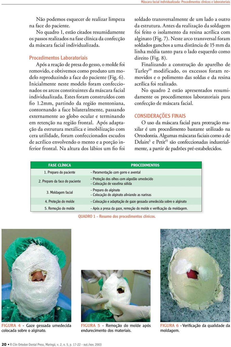 Procedimentos Laboratoriais Após a reação de presa do gesso, o molde foi removido, e obtivemos como produto um modelo reproduzindo a face do paciente (Fig. 6).