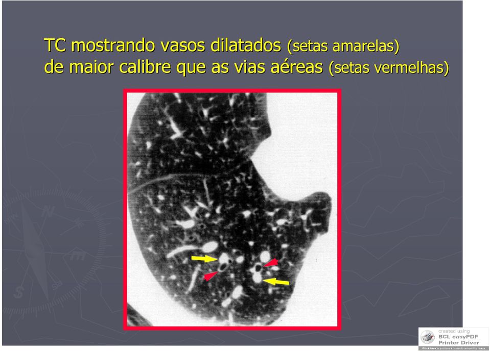 de maior calibre que as