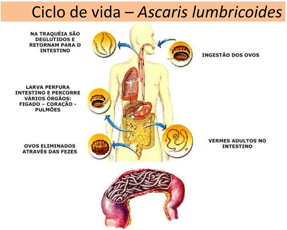 Ascaris