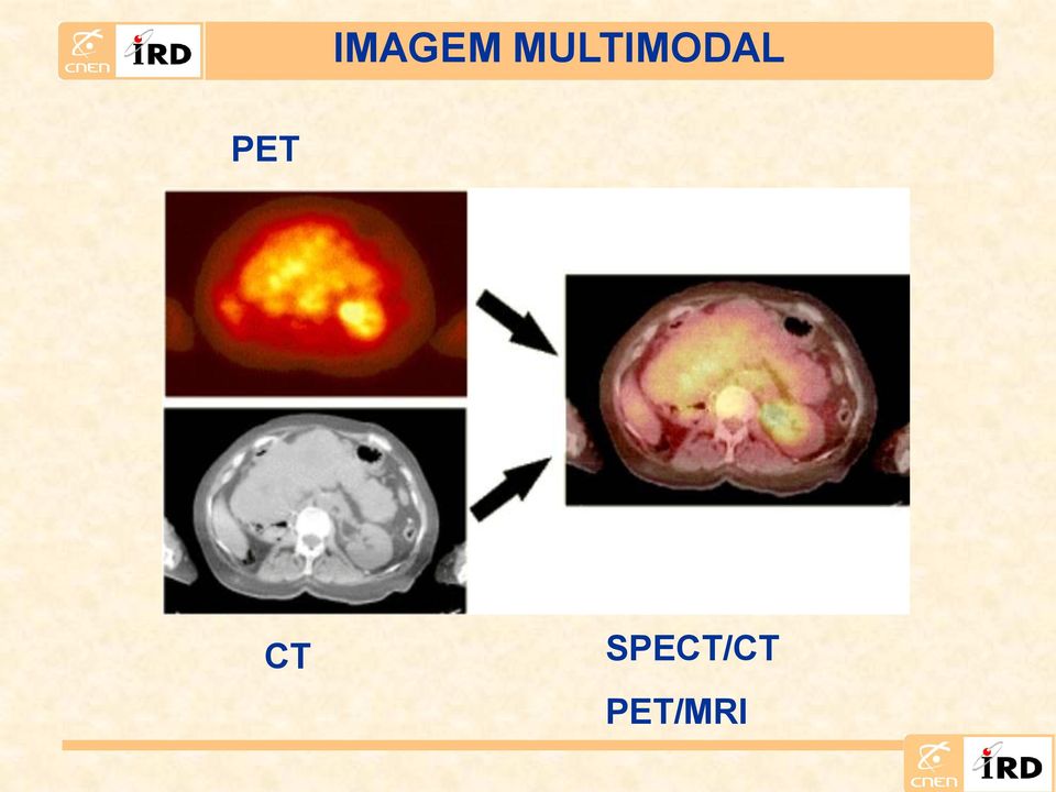 PET CT