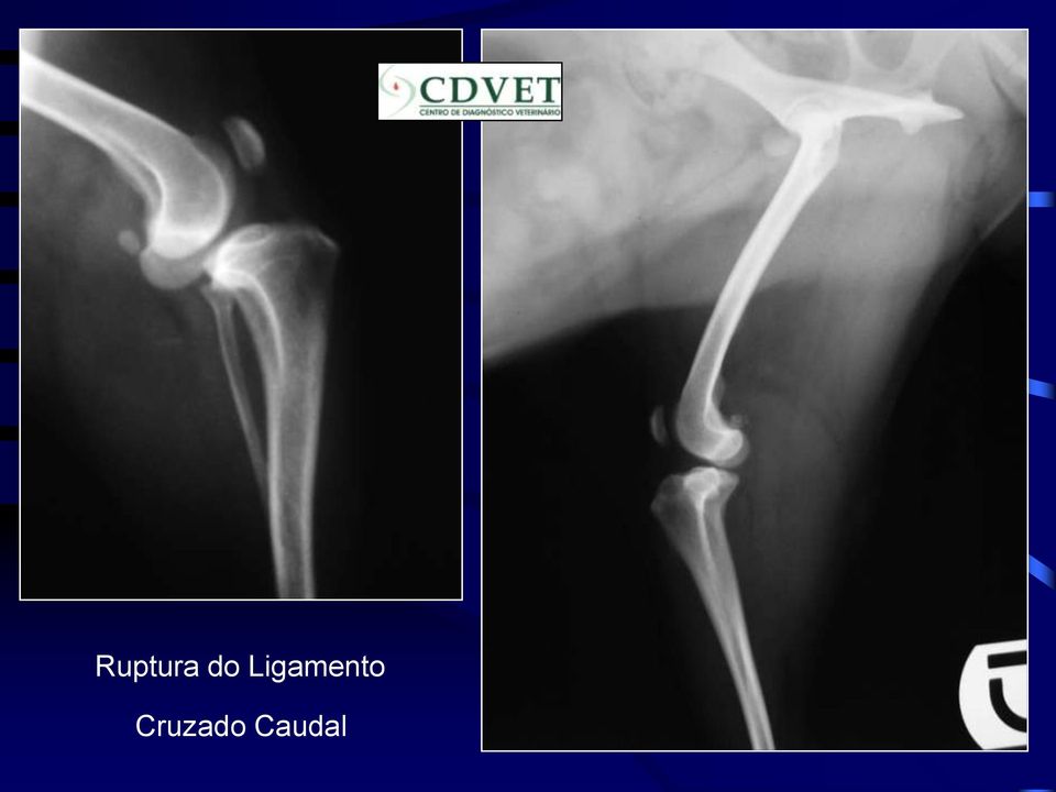 Ligamento