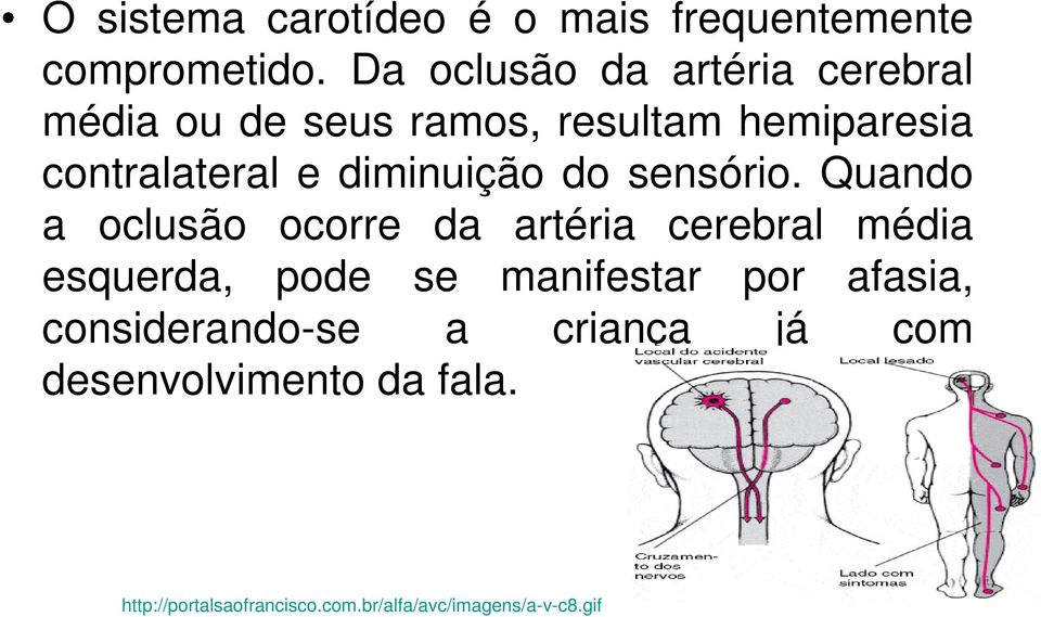 diminuição do sensório.