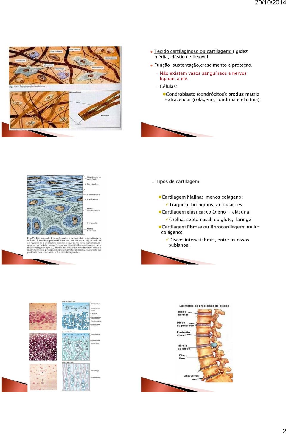 Células: Condroblasto (condrócitos): produz matriz extracelular (colágeno, condrina e elastina); Tipos de cartilagem: Cartilagem