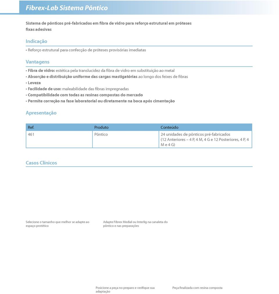 Leveza Facilidade de uso: maleabilidade das fibras impregnadas Compatibilidade com todas as resinas compostas do mercado Permite correção na fase laboratorial ou diretamente na boca após cimentação