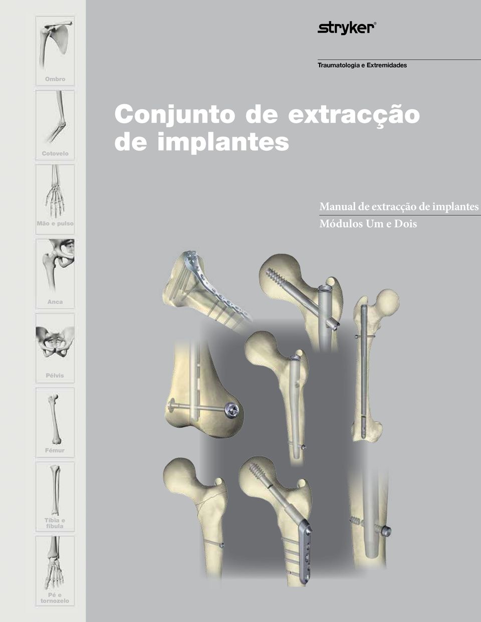 Manual de extracção de implantes Módulos Um e