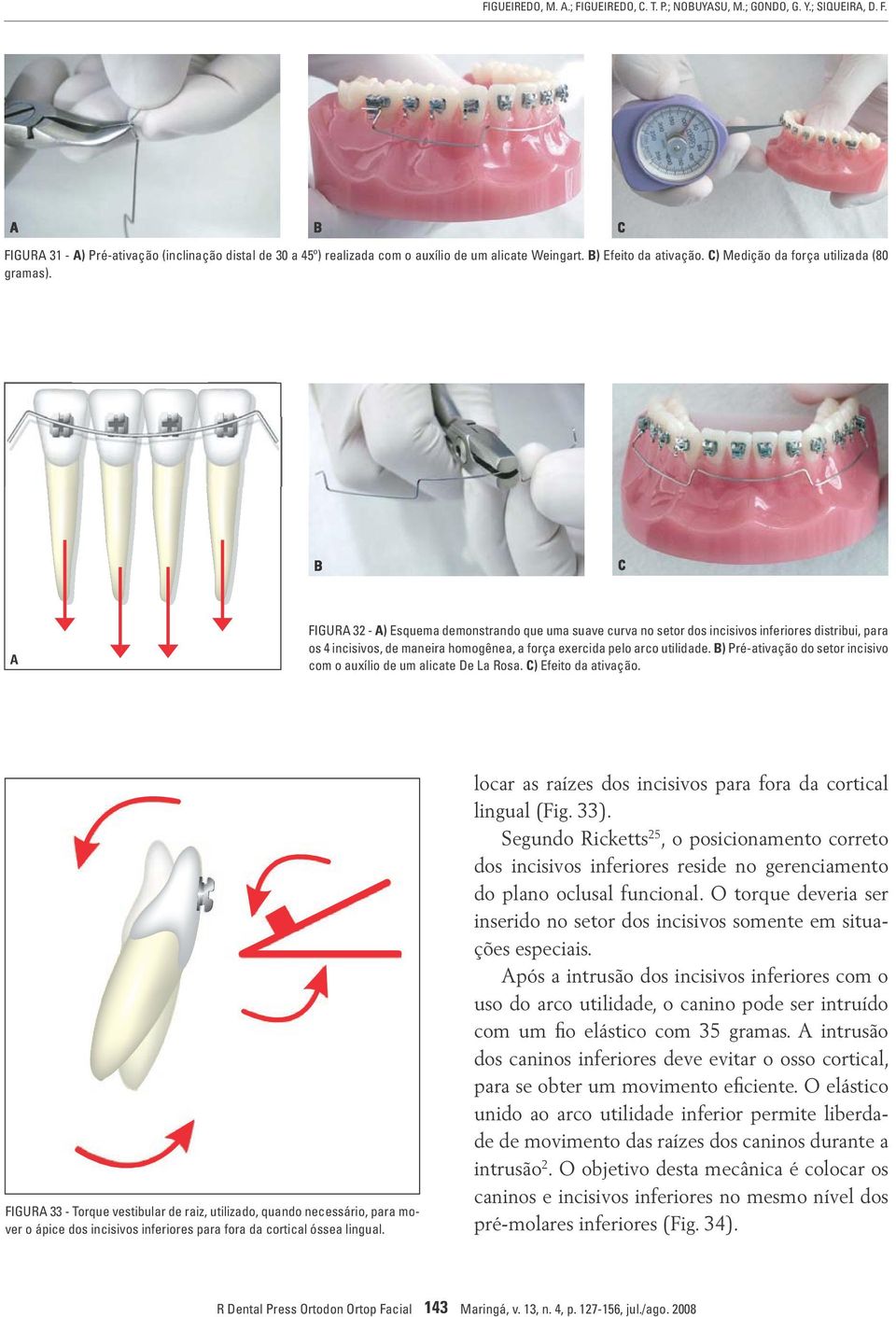 FIGUR 32 - ) Esquema demonstrando que uma suave curva no setor dos incisivos inferiores distribui, para os 4 incisivos, de maneira homogênea, a força exercida pelo arco utilidade.