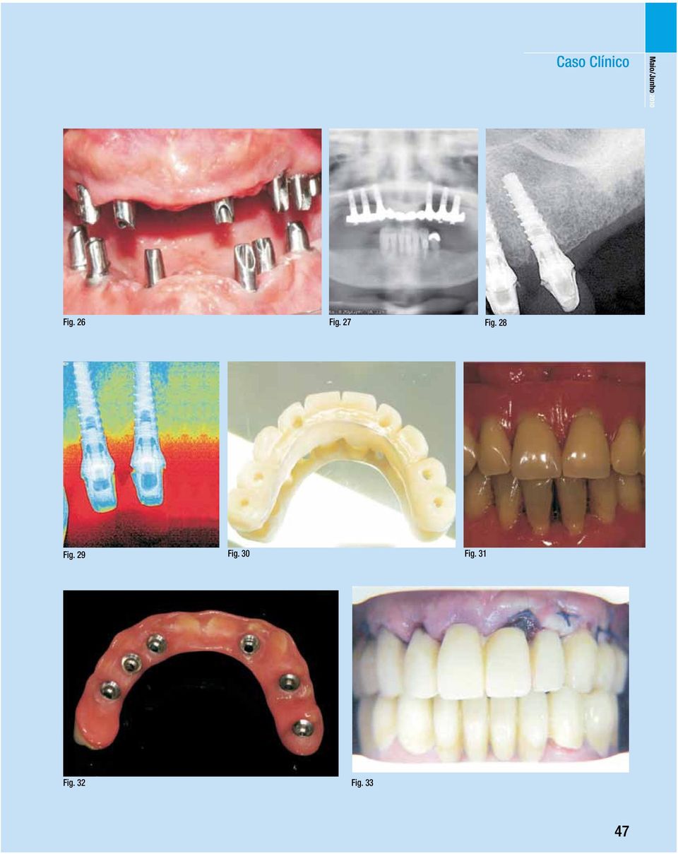 27 Fig. 28 Fig. 29 Fig.