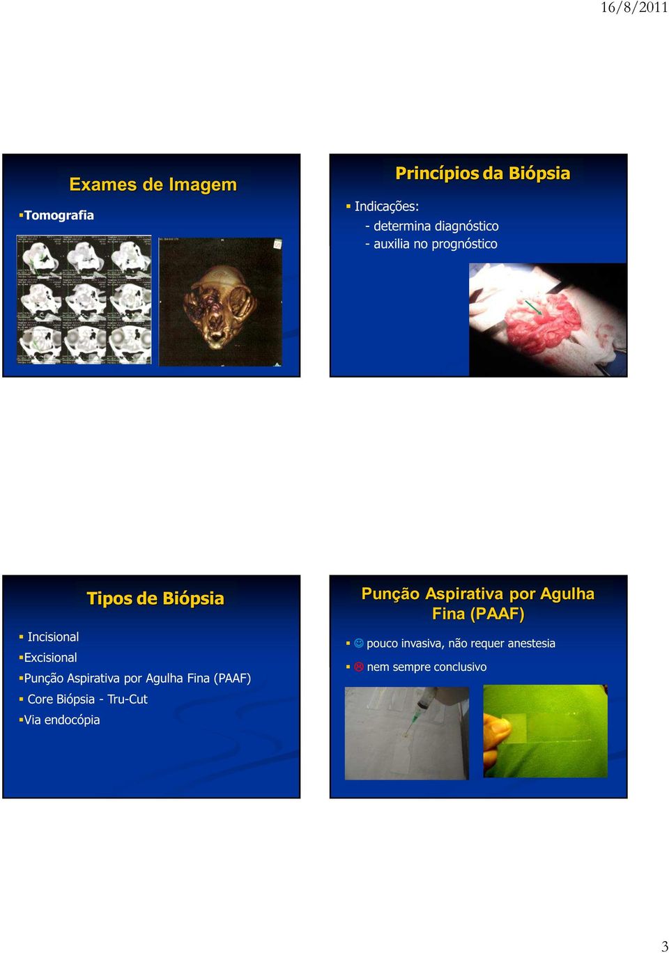 Aspirativa por Agulha Fina (PAAF) Core Biópsia - Tru-Cut Via endocópia Punção