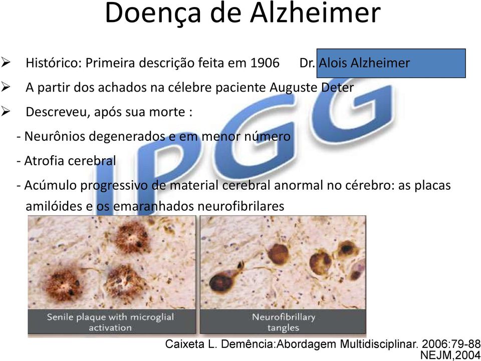 Alois Alzheimer A partir dos achados na célebre paciente Auguste Deter Descreveu, após sua morte : -