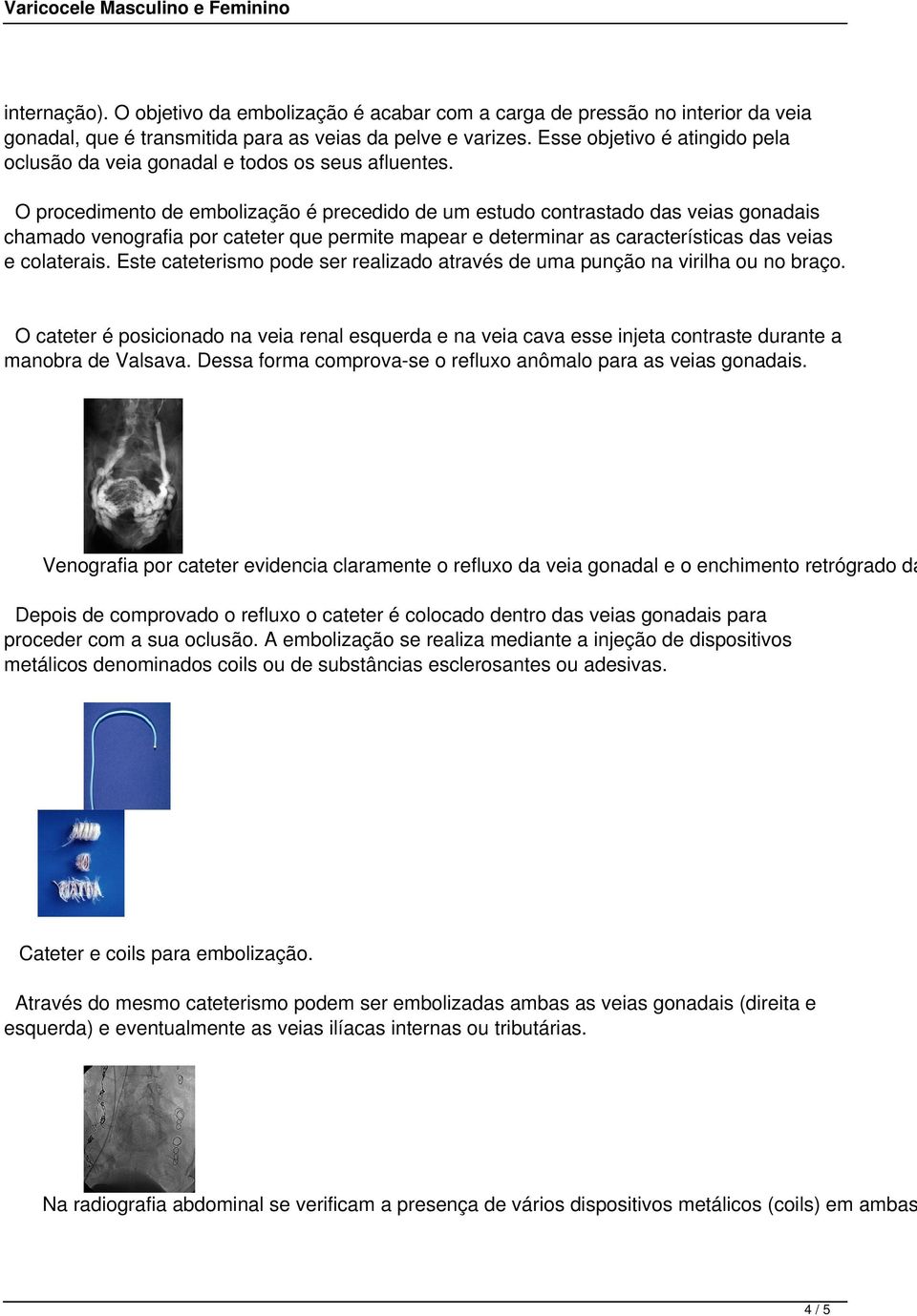 O procedimento de embolização é precedido de um estudo contrastado das veias gonadais chamado venografia por cateter que permite mapear e determinar as características das veias e colaterais.