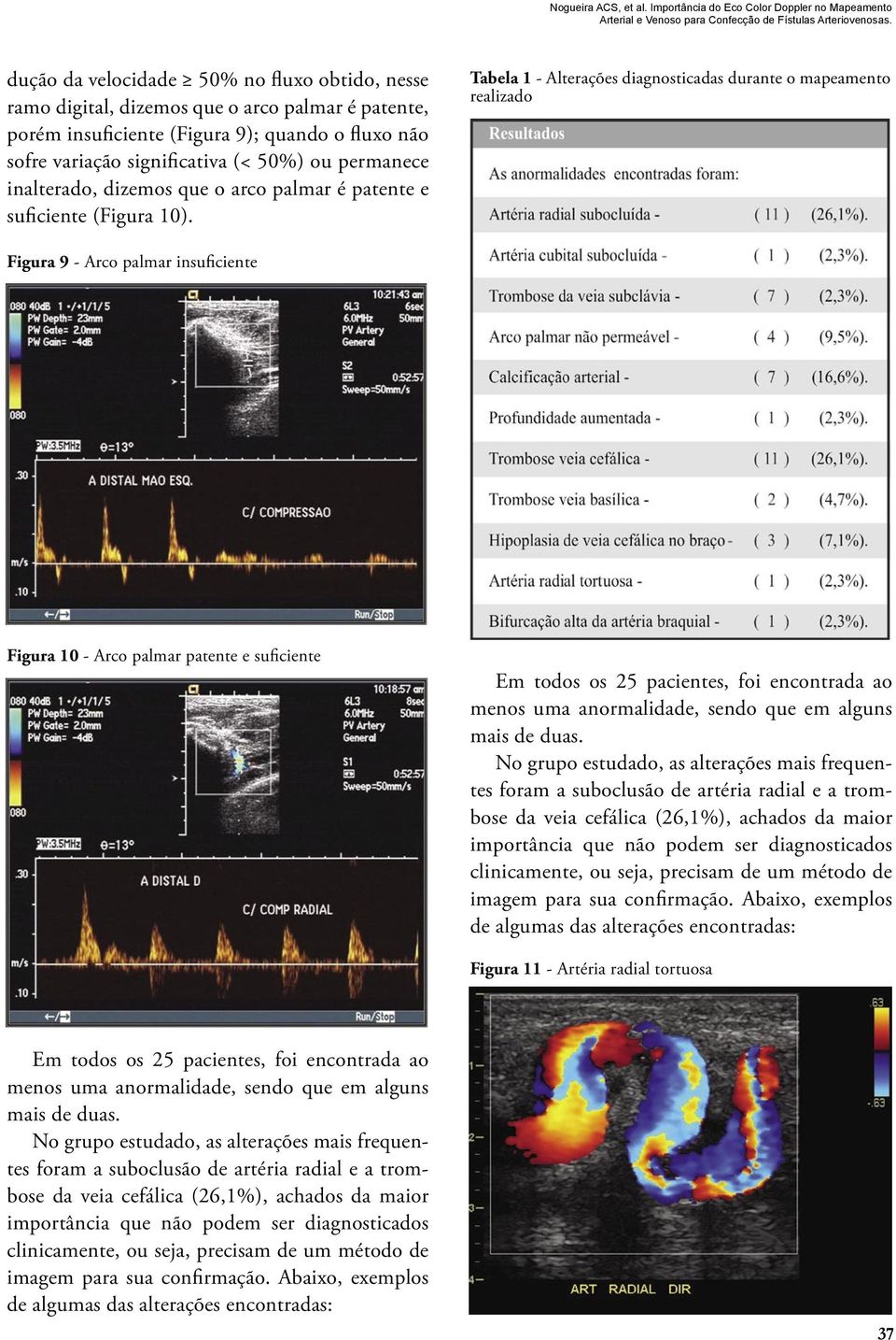 inalterado, dizemos que o arco palmar é patente e suficiente (Figura 10).