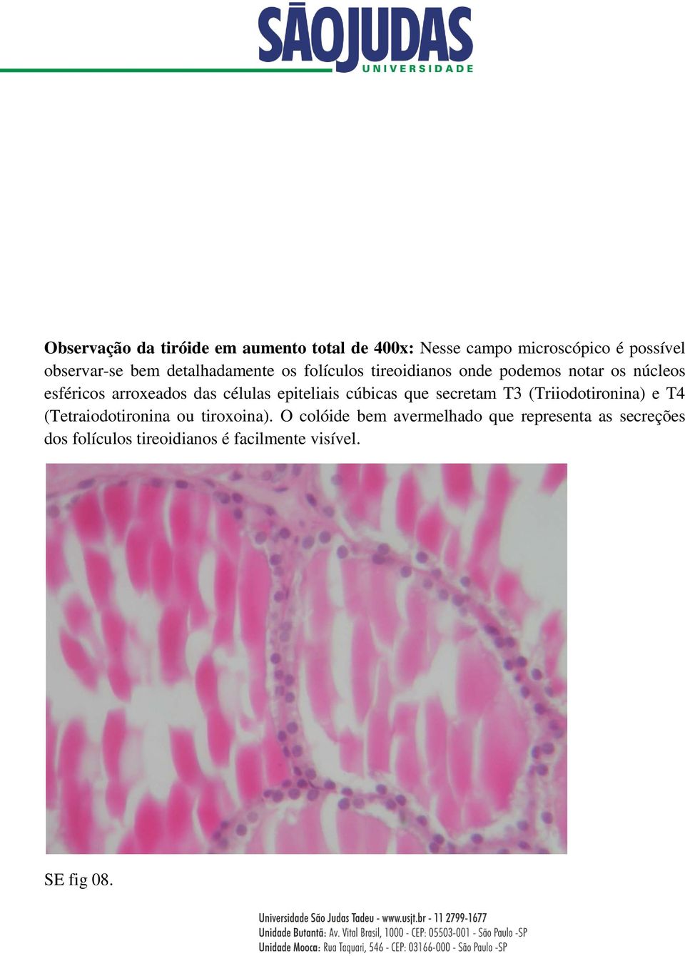 células epiteliais cúbicas que secretam T3 (Triiodotironina) e T4 (Tetraiodotironina ou tiroxoina).