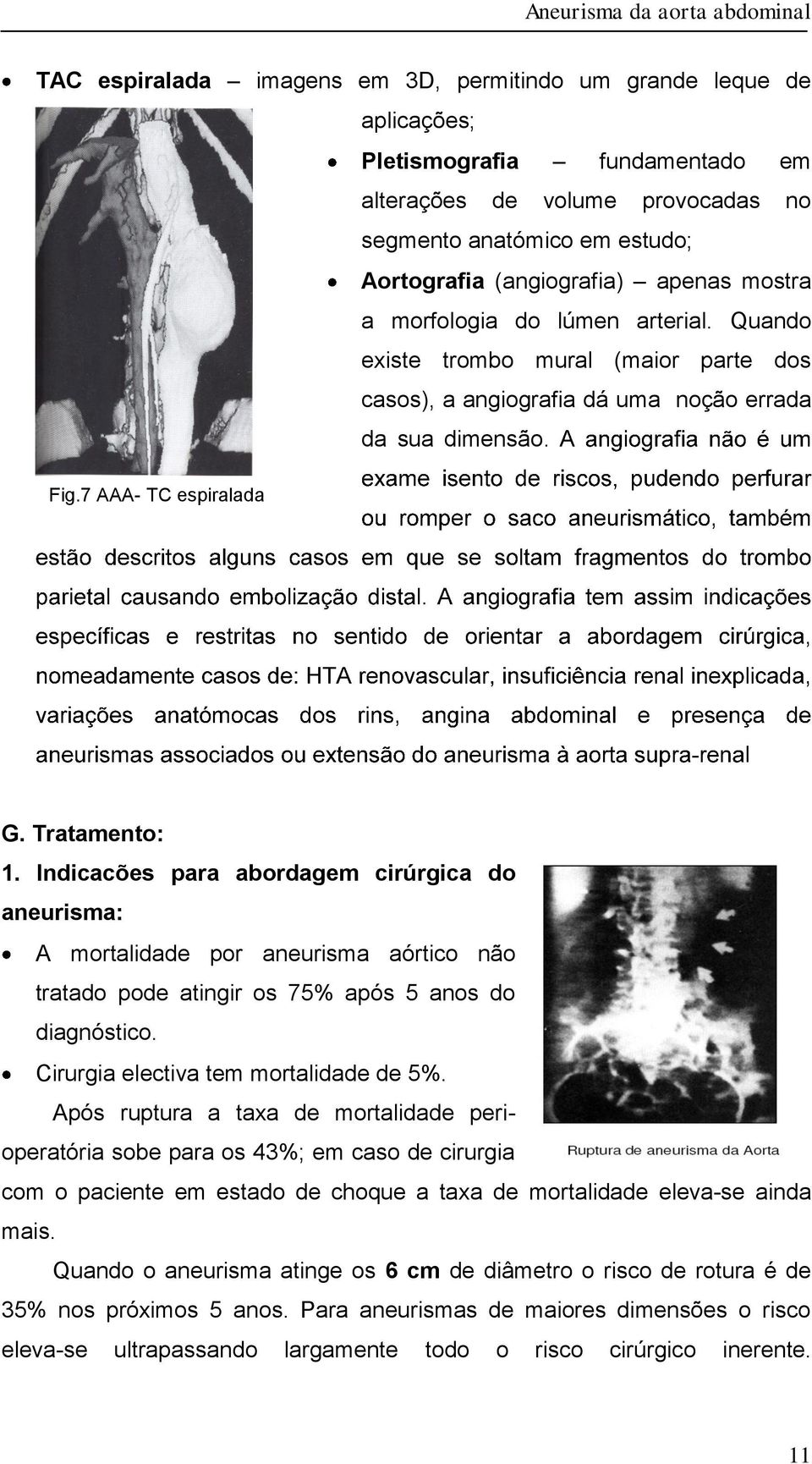 Indicacões para abordagem cirúrgica do aneurisma: A mortalidade por aneurisma aórtico não tratado pode atingir os 75% após 5 anos do diagnóstico. Cirurgia electiva tem mortalidade de 5%.