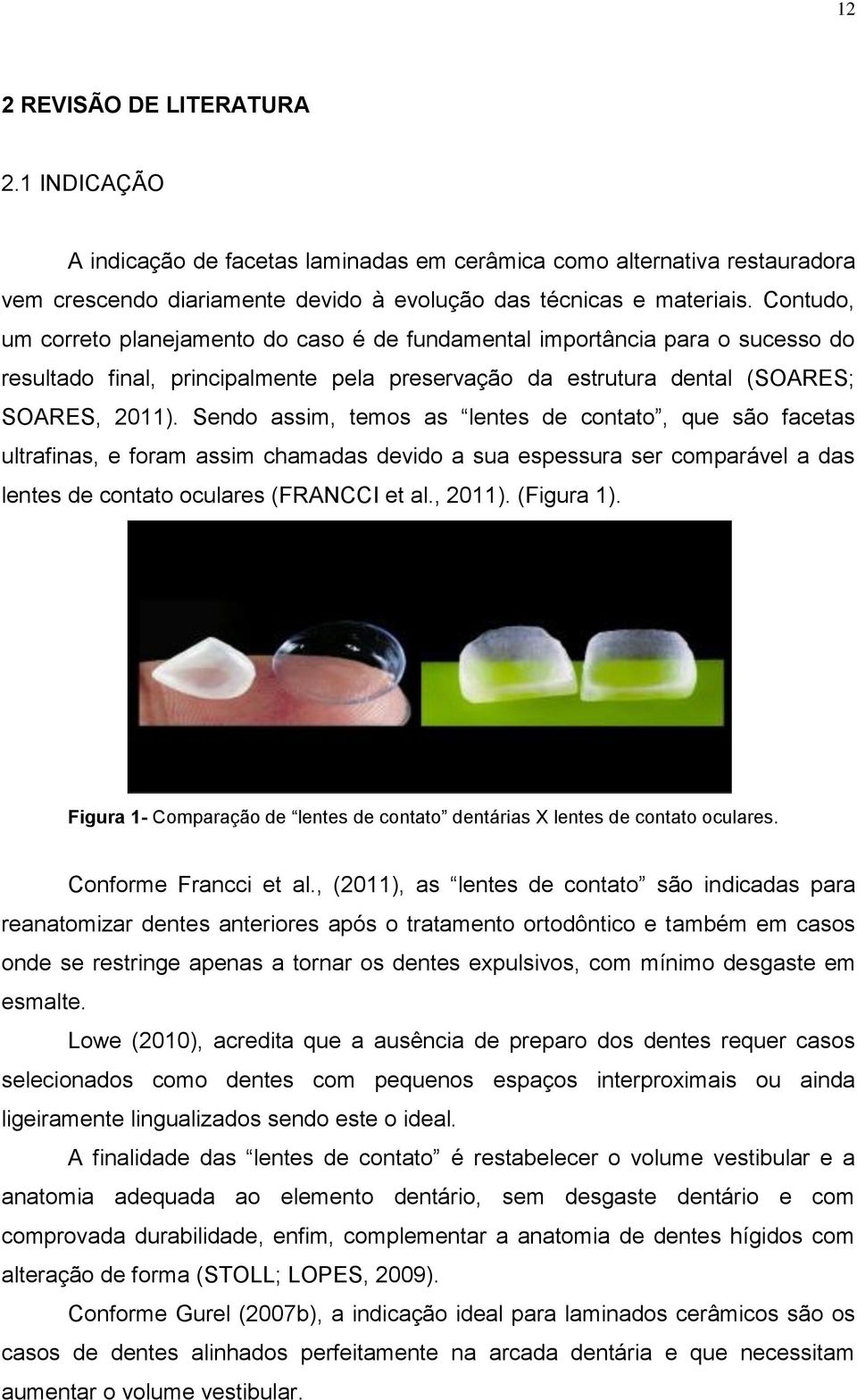 Sendo assim, temos as lentes de contato, que são facetas ultrafinas, e foram assim chamadas devido a sua espessura ser comparável a das lentes de contato oculares (FRANCCI et al., 2011). (Figura 1).