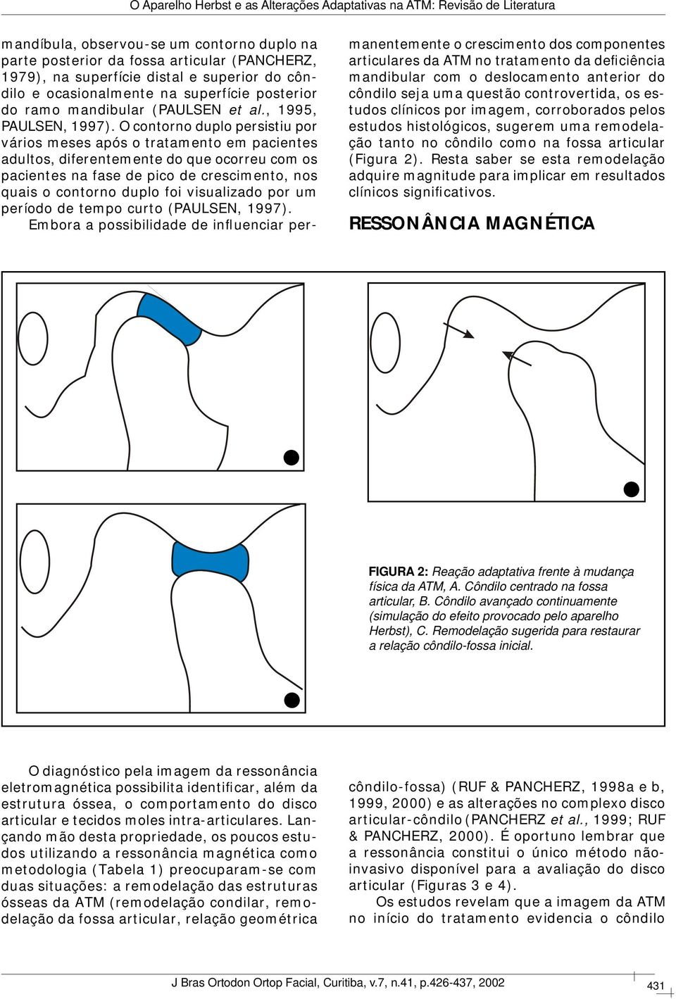 O contorno duplo persistiu por vários meses após o tratamento em pacientes adultos, diferentemente do que ocorreu com os pacientes na fase de pico de crescimento, nos quais o contorno duplo foi