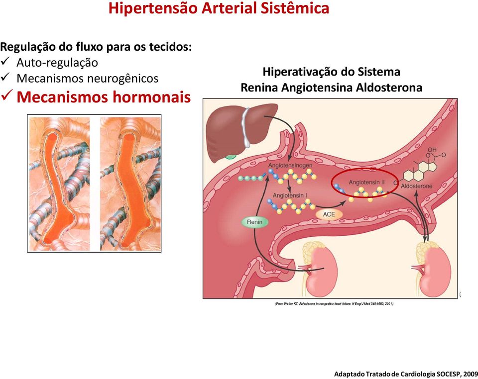 Mecanismos hormonais Hiperativação do Sistema Renina