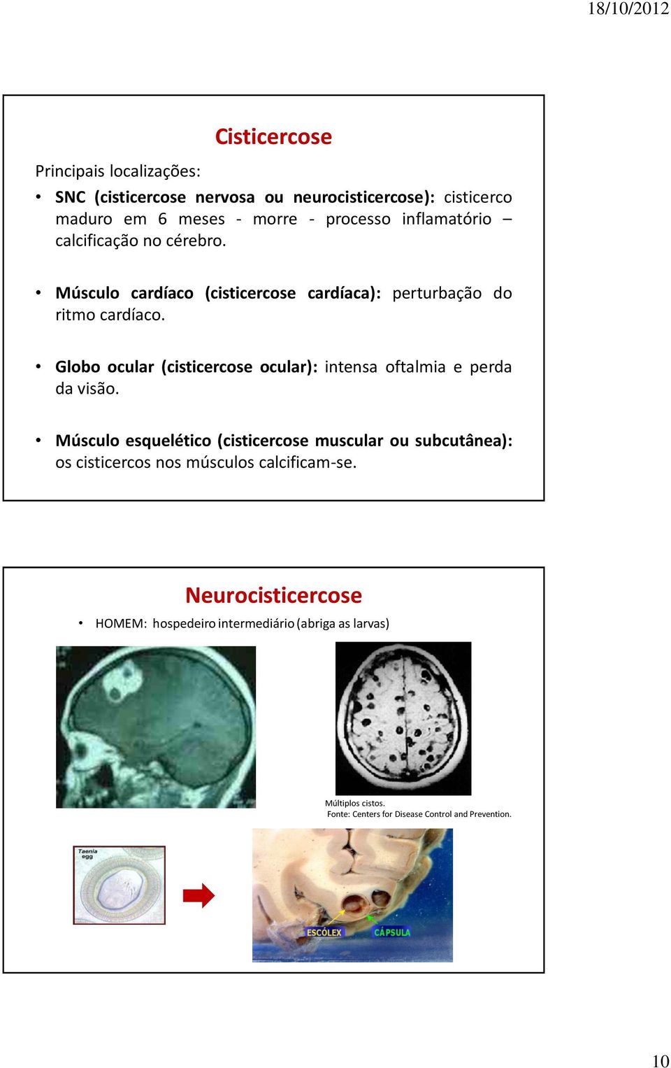 Globo ocular (cisticercose ocular): intensa oftalmia e perda da visão.