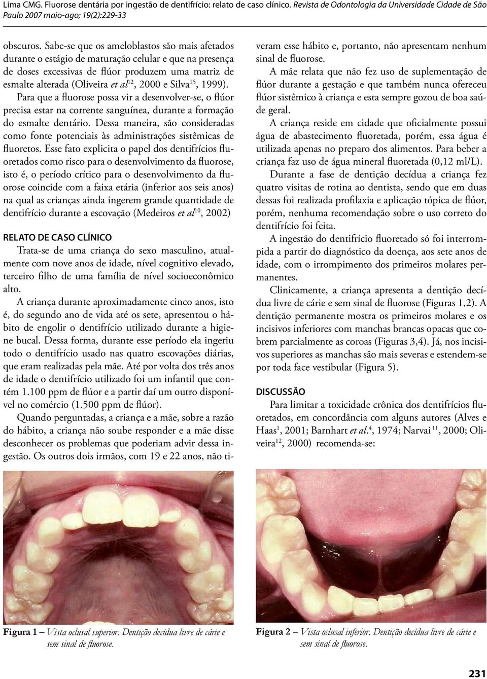 Silva 15, 1999). Para que a fluorose possa vir a desenvolver-se, o flúor precisa estar na corrente sanguínea, durante a formação do esmalte dentário.
