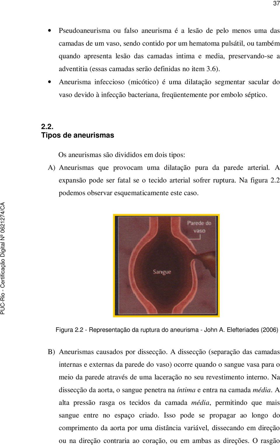 Aneurisma infeccioso (micótico) é uma dilatação segmentar sacular do vaso devido à infecção bacteriana, freqüentemente por embolo séptico. 2.