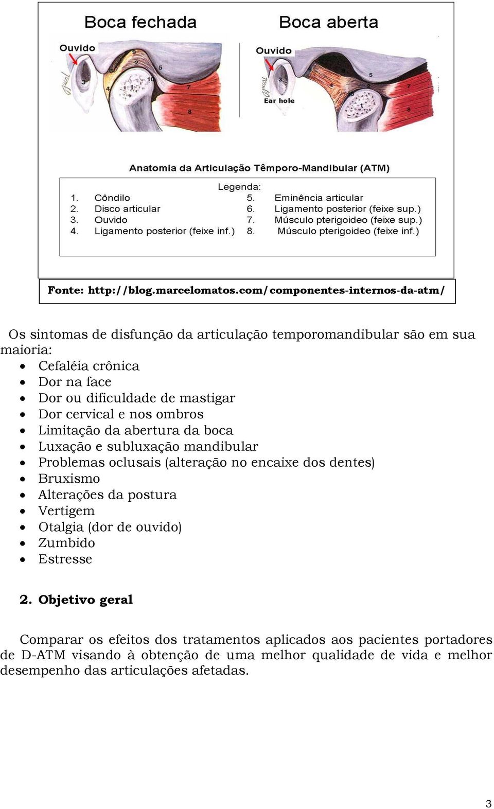 dificuldade de mastigar Dor cervical e nos ombros Limitação da abertura da boca Luxação e subluxação mandibular Problemas oclusais (alteração no encaixe