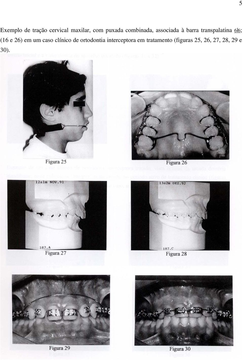 (16 e 26) em um caso clínico de ortodontia