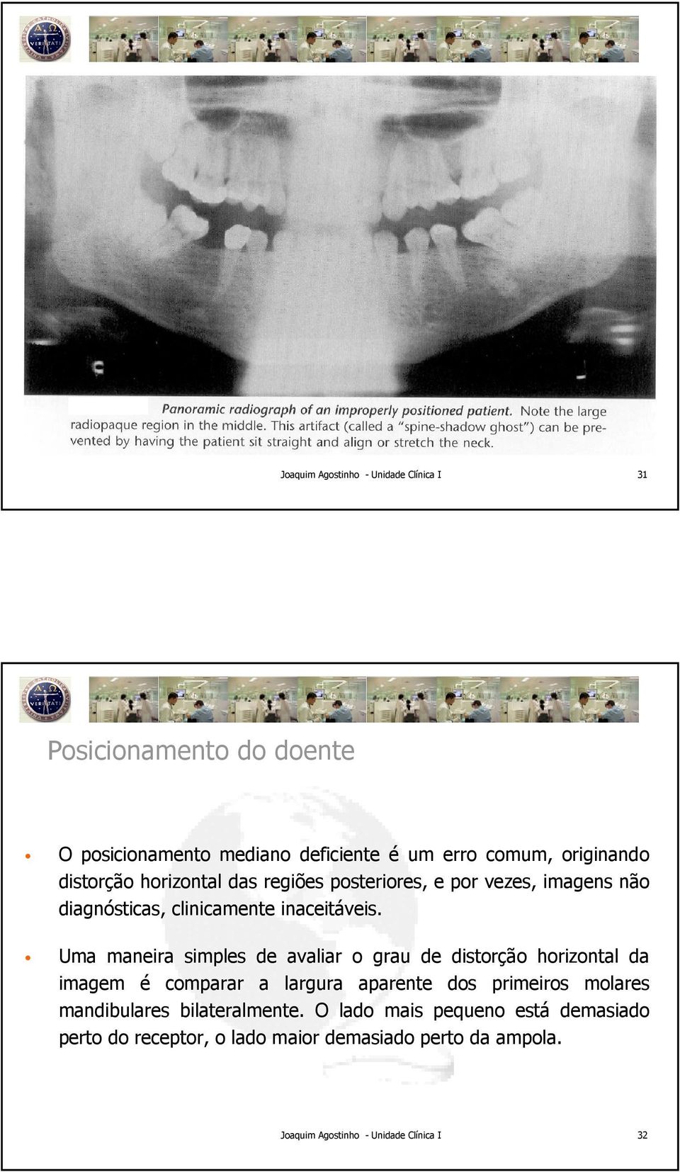 Uma maneira simples de avaliar o grau de distorção horizontal da imagem é comparar a largura aparente dos