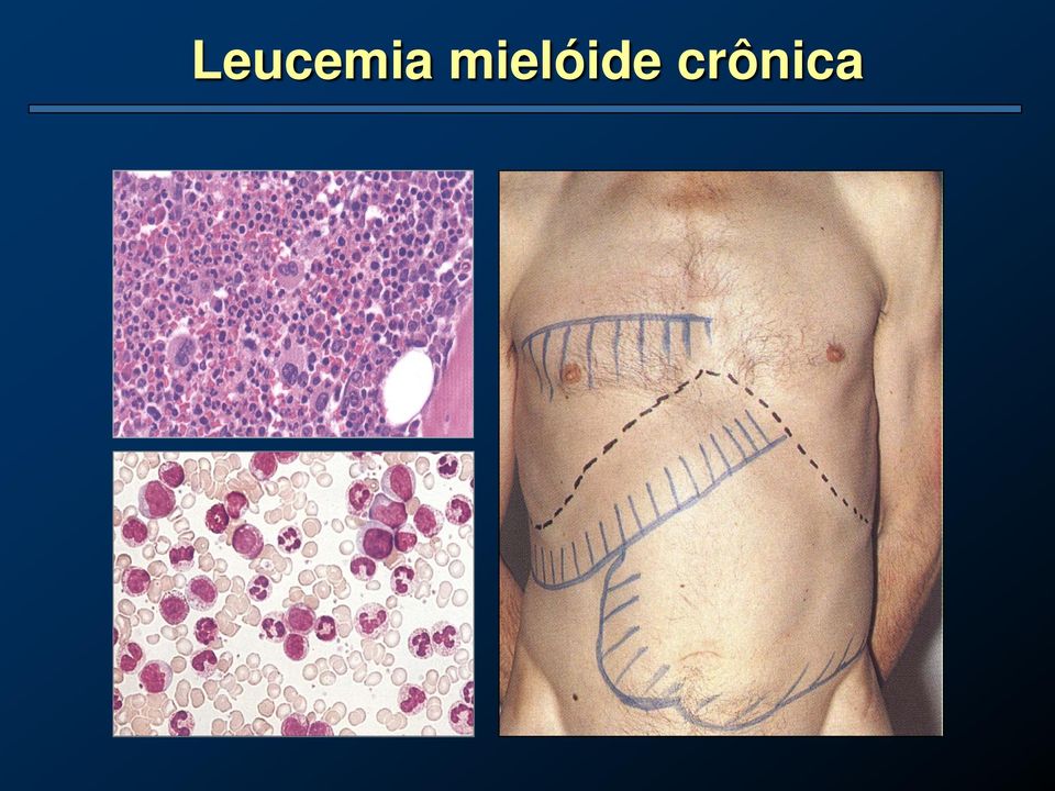 crônica