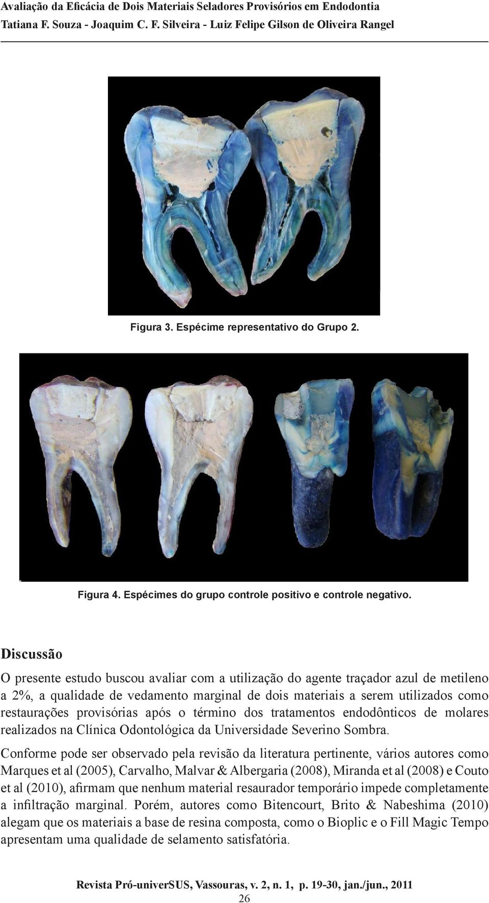 provisórias após o término dos tratamentos endodônticos de molares realizados na Clínica Odontológica da Universidade Severino Sombra.