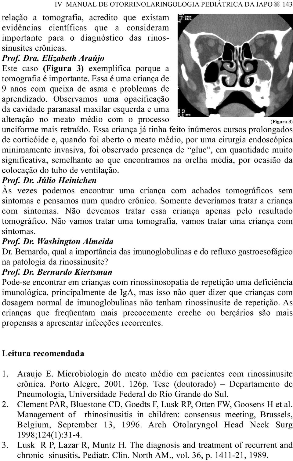 Observamos uma opacificação da cavidade paranasal maxilar esquerda e uma alteração no meato médio com o processo (Figura 3) unciforme mais retraído.