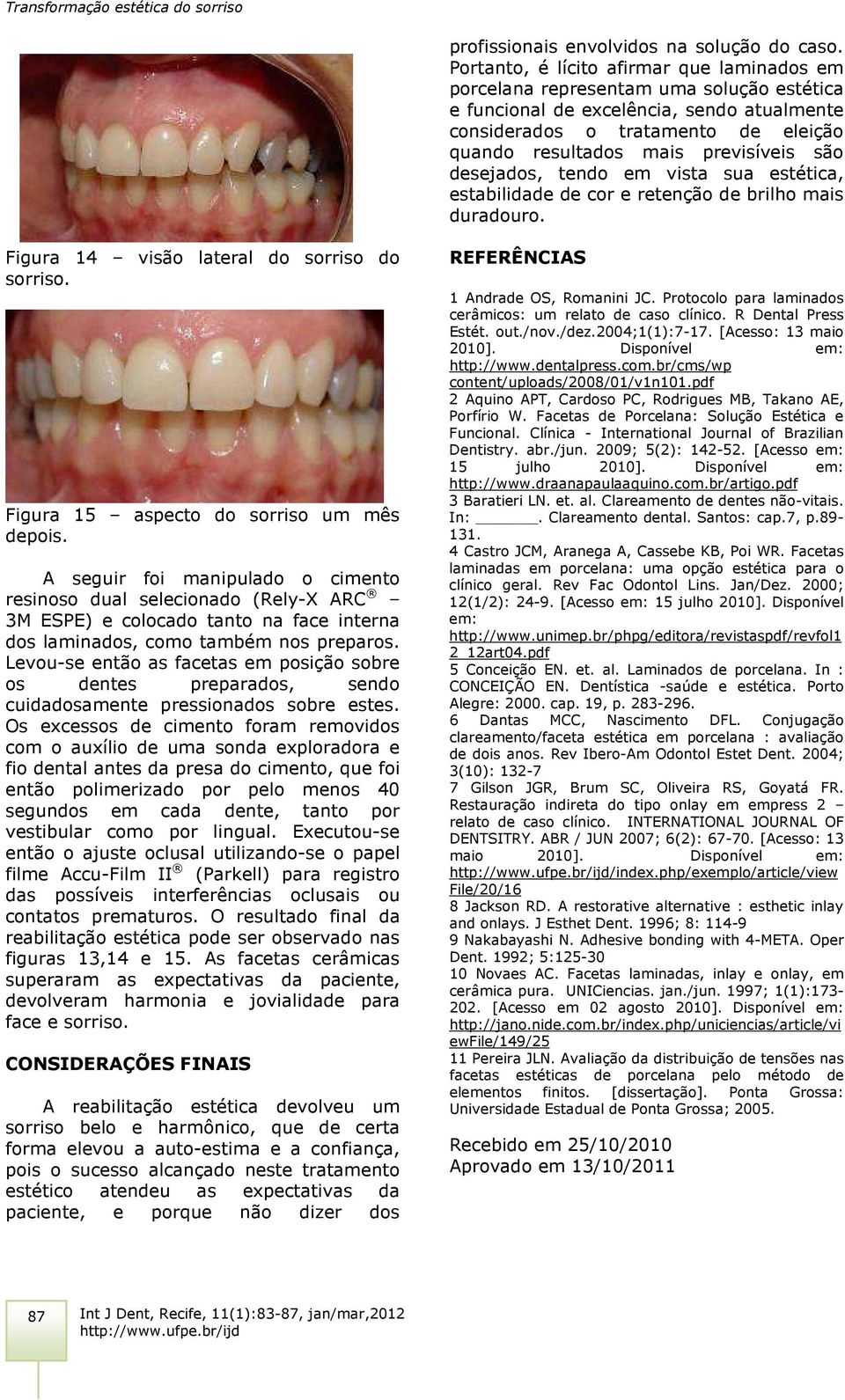 previsíveis são desejados, tendo em vista sua estética, estabilidade de cor e retenção de brilho mais duradouro. Figura 14 visão lateral do sorriso do sorriso.