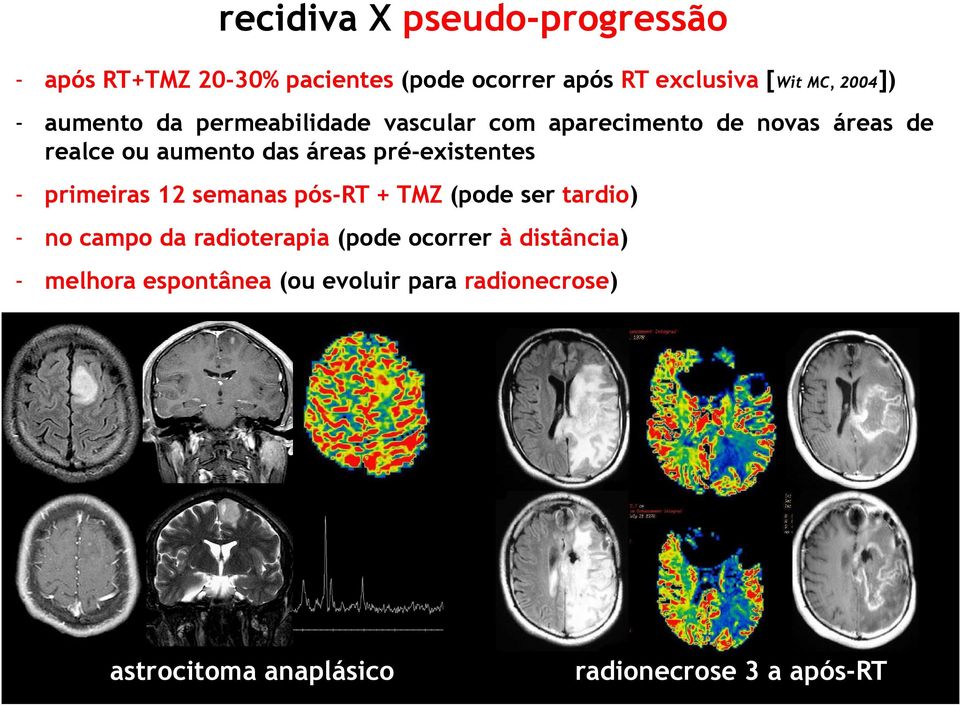 pré-existentes - primeiras 12 semanas pós-rt + TMZ (pode ser tardio) - no campo da radioterapia (pode