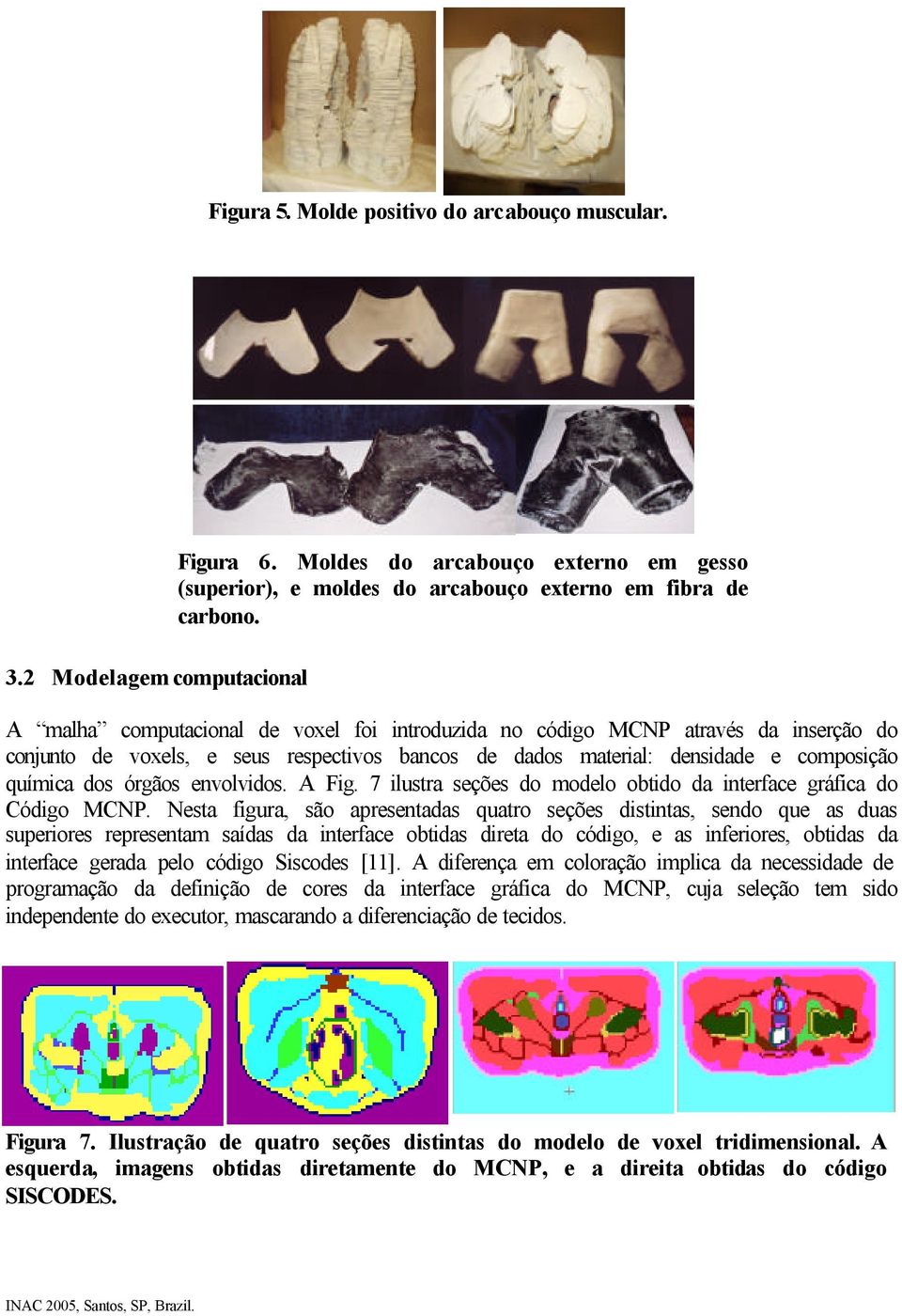 envolvidos. A Fig. 7 ilustra seções do modelo obtido da interface gráfica do Código MCNP.