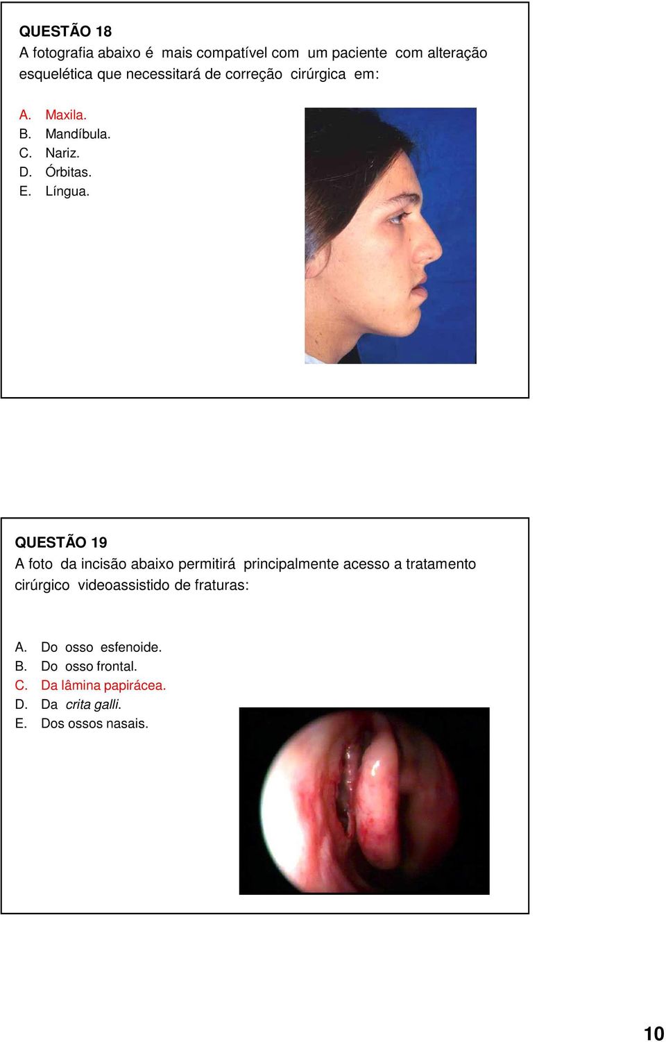 QUESTÃO 19 A foto da incisão abaixo permitirá principalmente acesso a tratamento cirúrgico