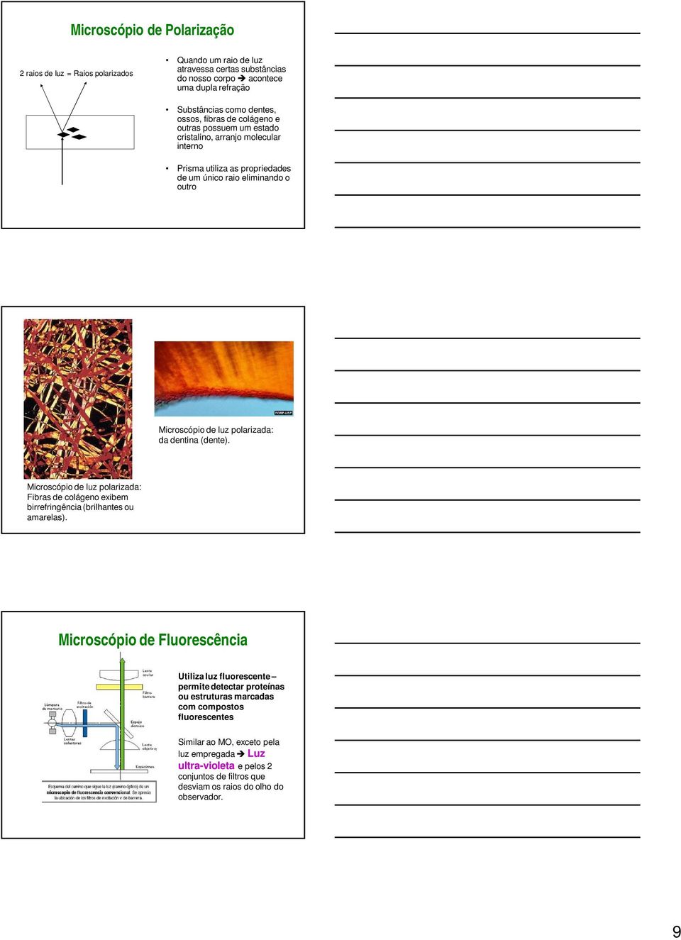 dentina (dente). Microscópio de luz polarizada: Fibras de colágeno exibem birrefringência (brilhantes ou amarelas).
