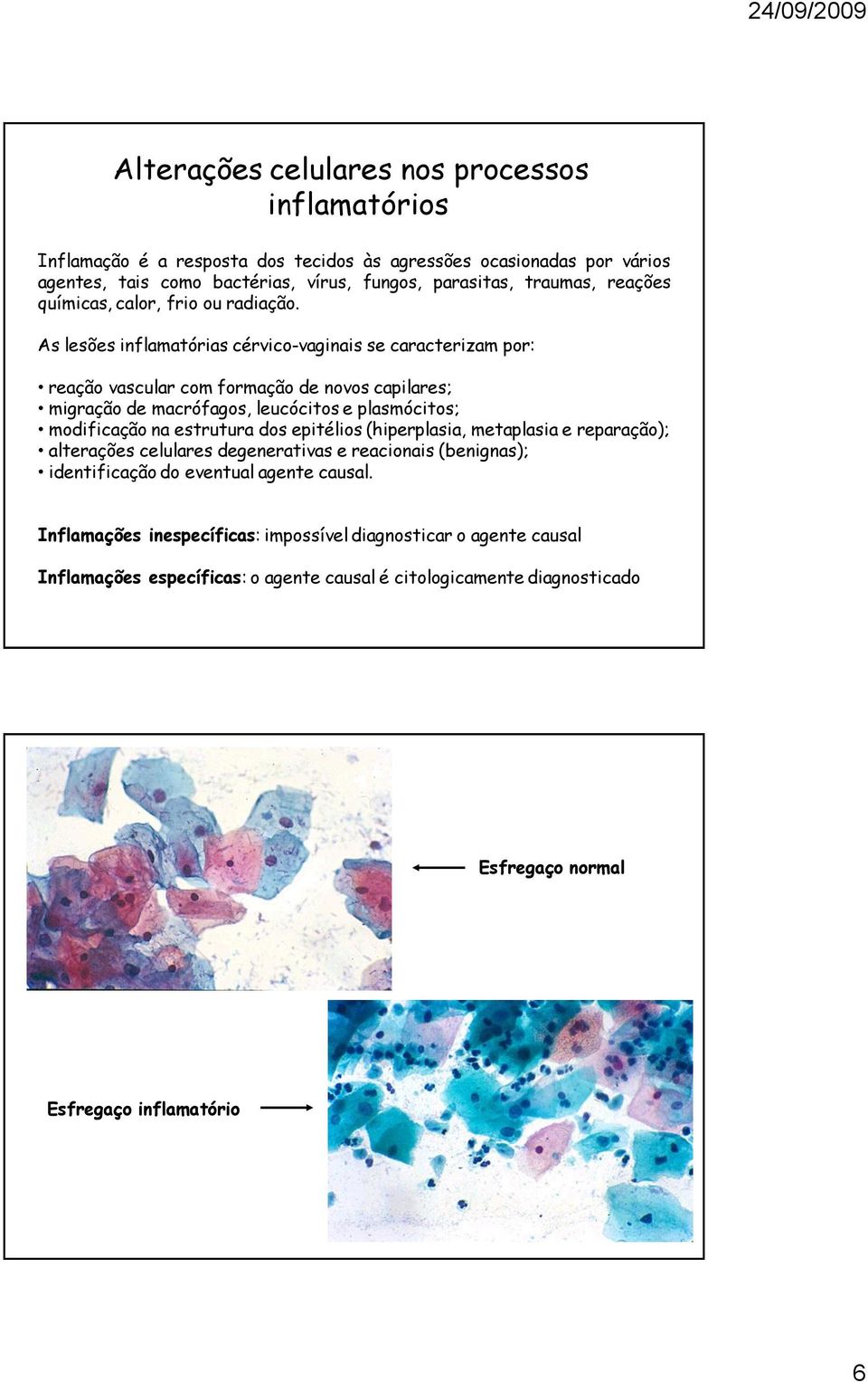 As lesões inflamatórias cérvico-vaginais se caracterizam por: reação vascular com formação de novos capilares; migração de macrófagos, leucócitos e plasmócitos; modificação na estrutura