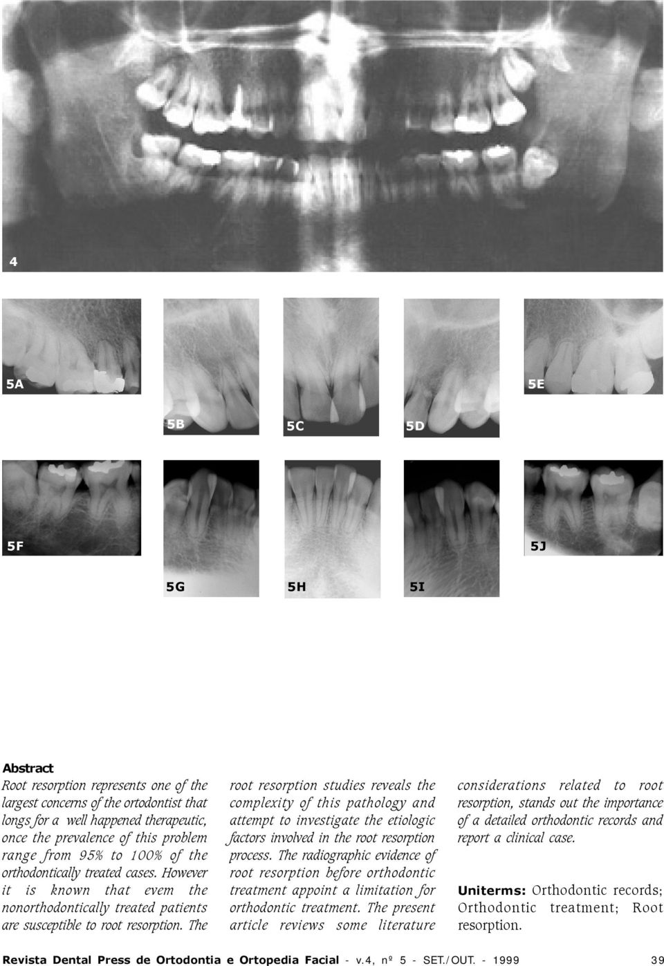 The root resorption studies reveals the complexity of this pathology and attempt to investigate the etiologic factors involved in the root resorption process.