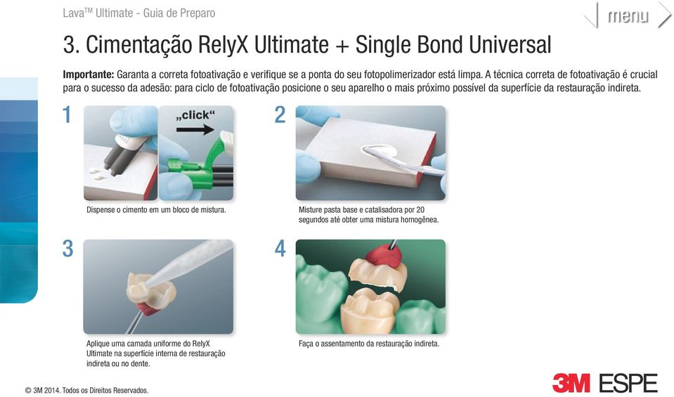 superfície da restauração indireta. 1 2 Dispense o cimento em um bloco de mistura.