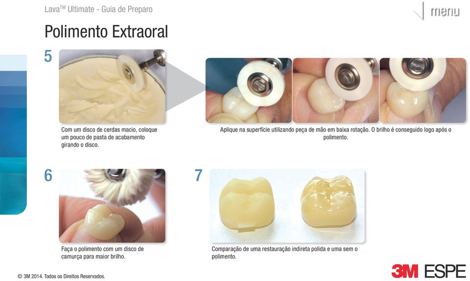 Aplique na superfície utilizando peça de mão em baixa rotação.