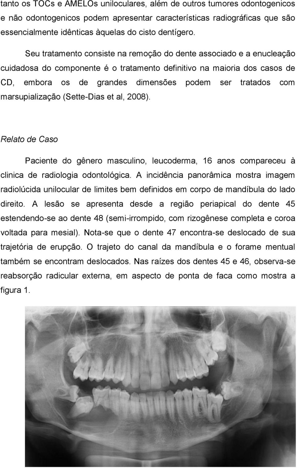 Seu tratamento consiste na remoção do dente associado e a enucleação cuidadosa do componente é o tratamento definitivo na maioria dos casos de CD, embora os de grandes dimensões podem ser tratados