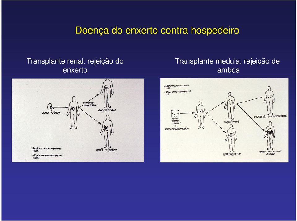 renal: rejeição do enxerto