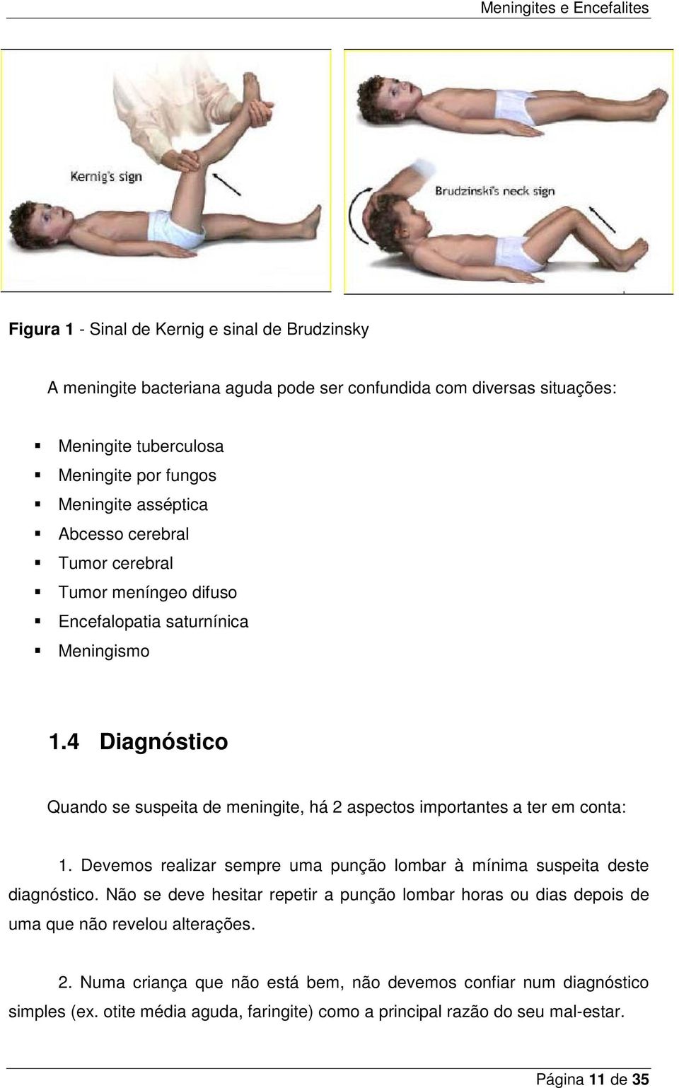 4 Diagnóstico Quando se suspeita de meningite, há 2 aspectos importantes a ter em conta: 1. Devemos realizar sempre uma punção lombar à mínima suspeita deste diagnóstico.