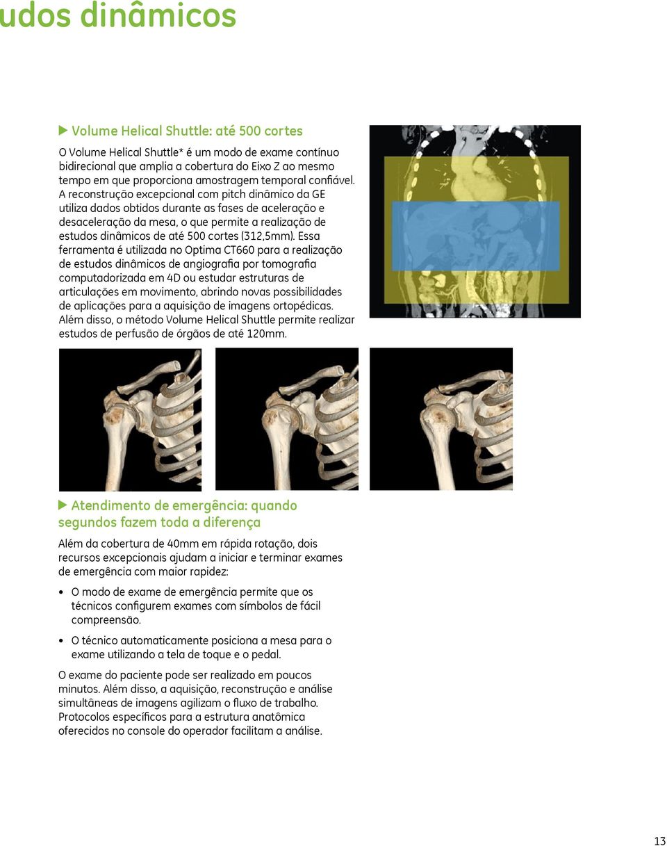 A reconstrução excepcional com pitch dinâmico da GE utiliza dados obtidos durante as fases de aceleração e desaceleração da mesa, o que permite a realização de estudos dinâmicos de até 500 cortes