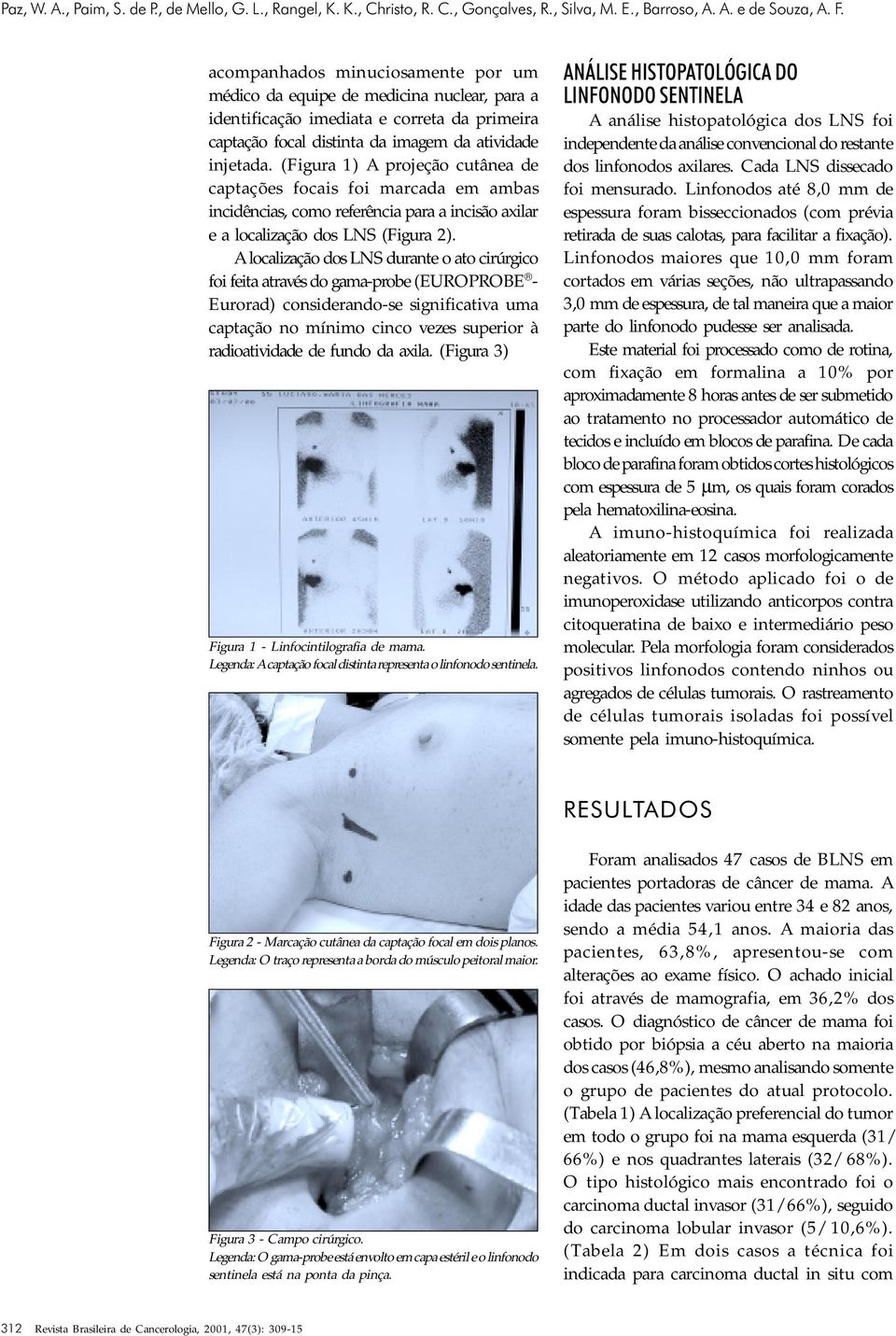 (Figura 1) A projeção cutânea de captações focais foi marcada em ambas incidências, como referência para a incisão axilar e a localização dos LNS (Figura 2).