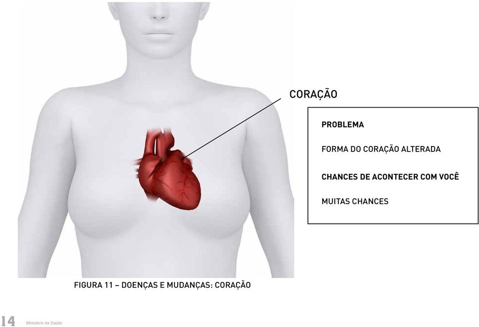 VOCÊ MUITAS CHANCES FIGURA 11 DOENÇAS