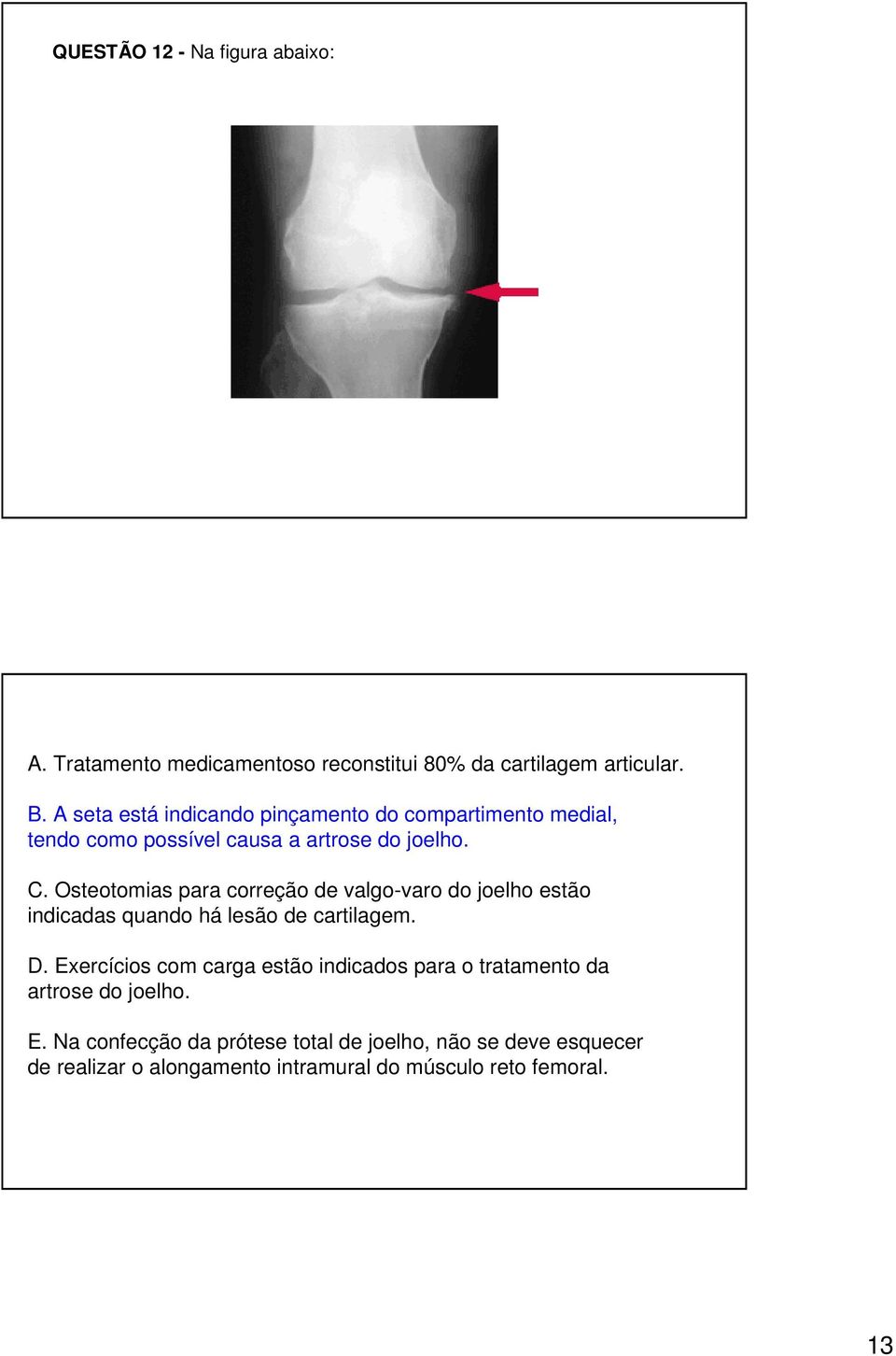 Osteotomias para correção de valgo-varo do joelho estão indicadas quando há lesão de cartilagem. D.