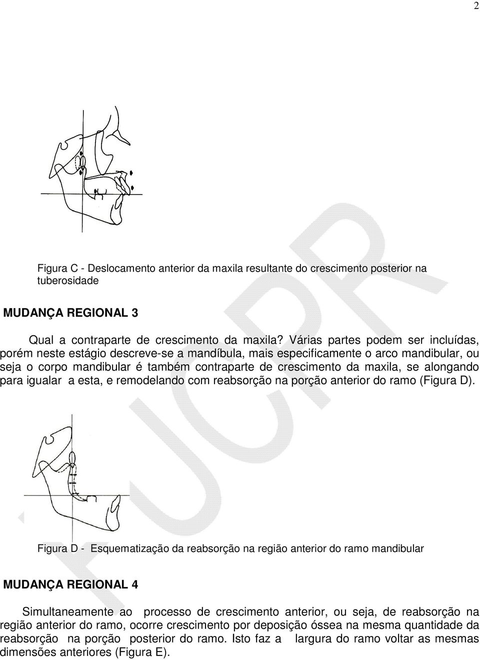 alongando para igualar a esta, e remodelando com reabsorção na porção anterior do ramo (Figura D).