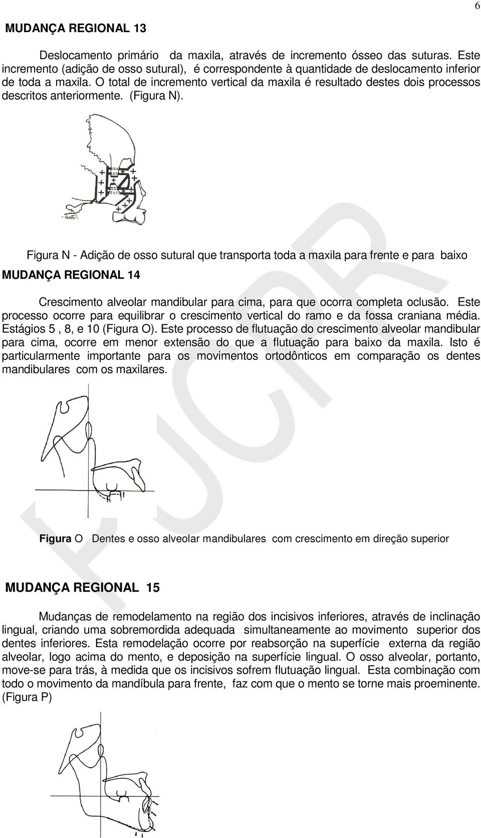 O total de incremento vertical da maxila é resultado destes dois processos descritos anteriormente. (Figura N).