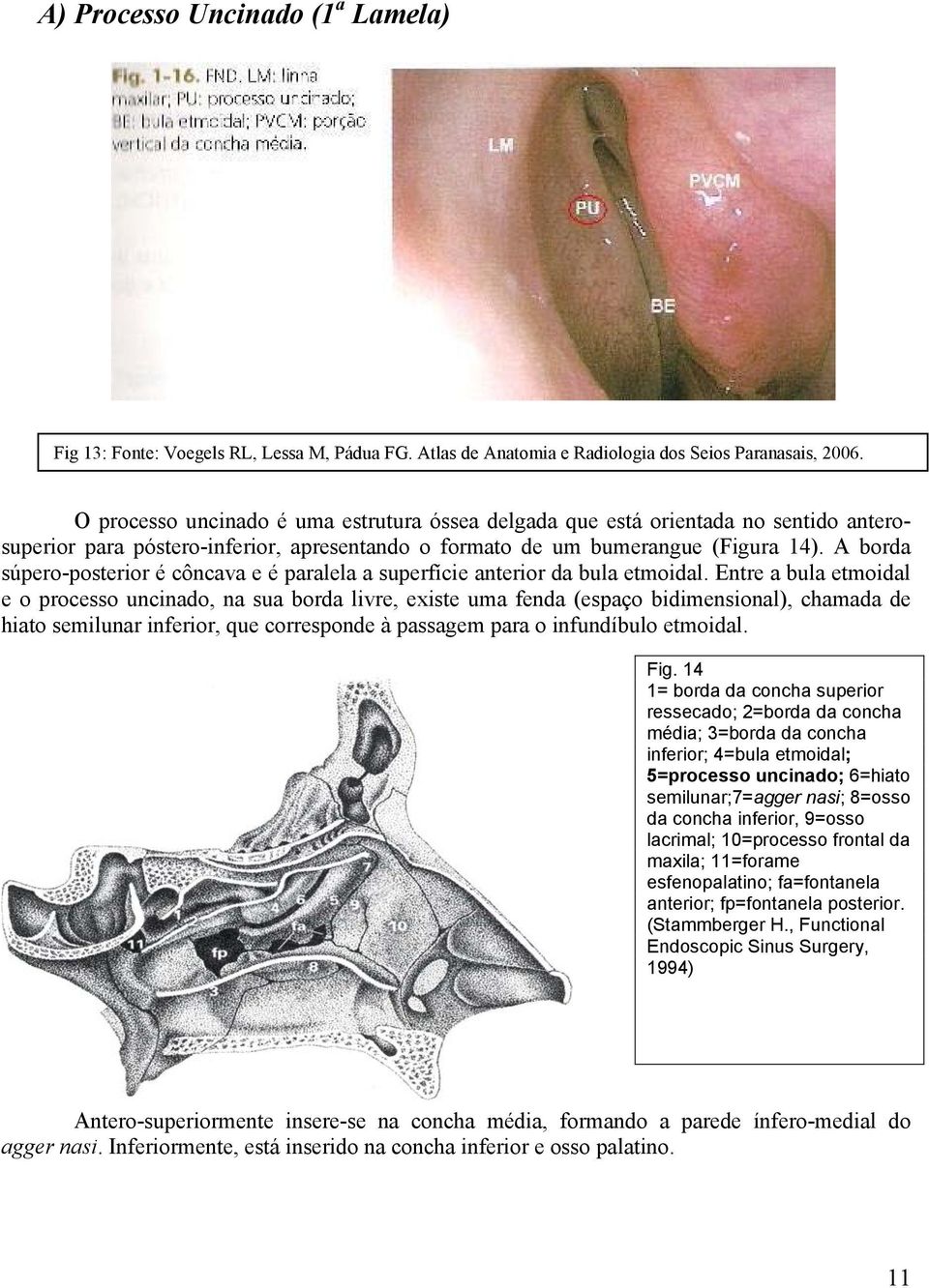 A borda súpero-posterior é côncava e é paralela a superfície anterior da bula etmoidal.